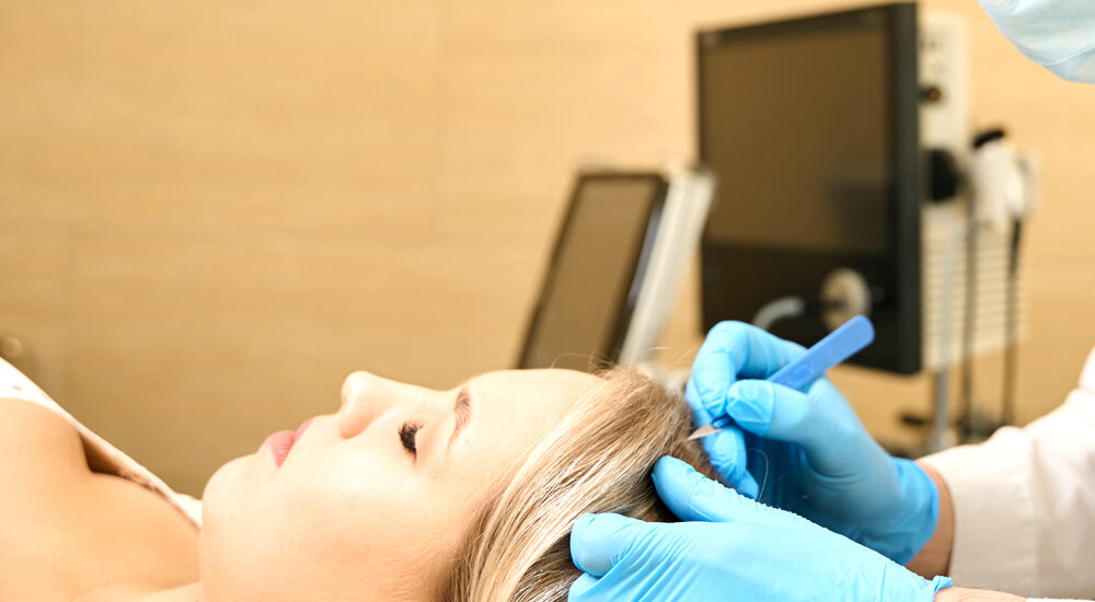 Nowoczesne metody przeszczepu włosów – innowacyjne techniki i ich efektywność w poprawie wyglądu. Chirurgia plastyczna Wrocław.