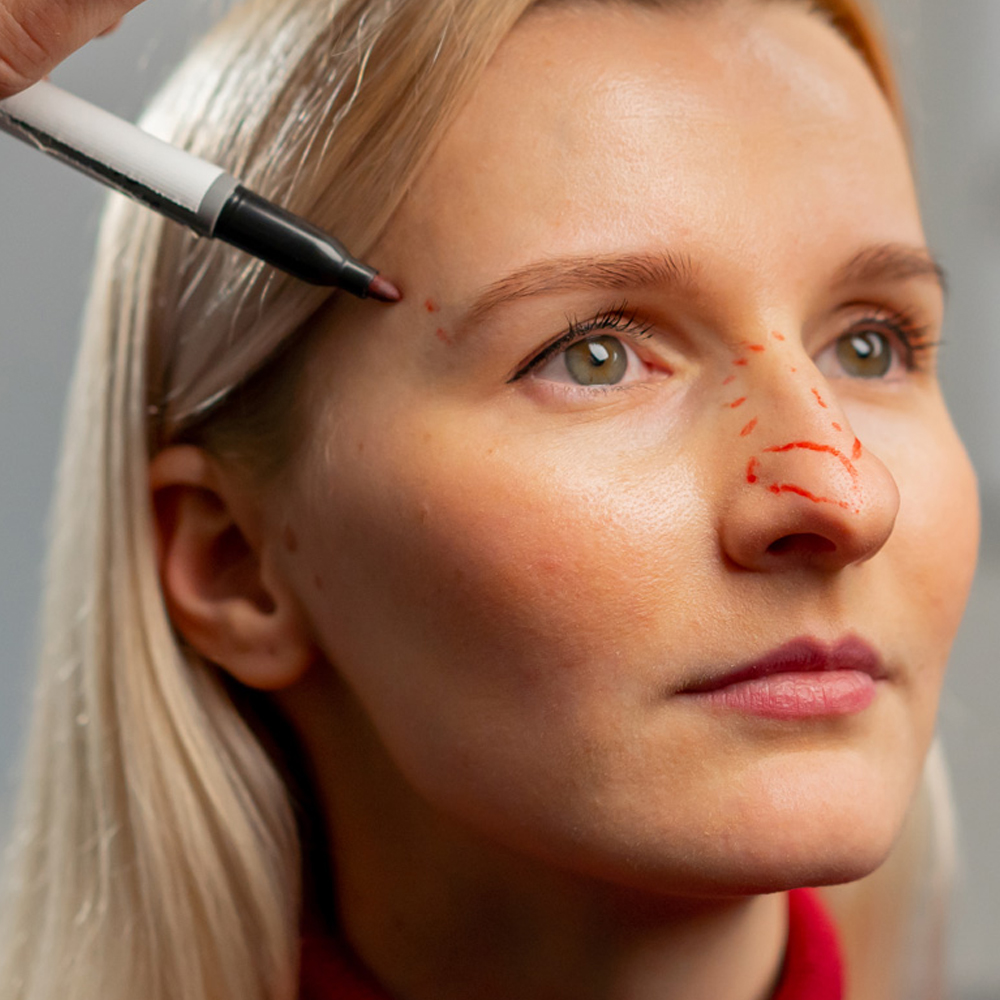 Plastyka nosa wspierająca funkcje zdrowotne – poprawa przegrody nosowej, oddychania i redukcja chrapania. Chirurgia plastyczna Wrocław.