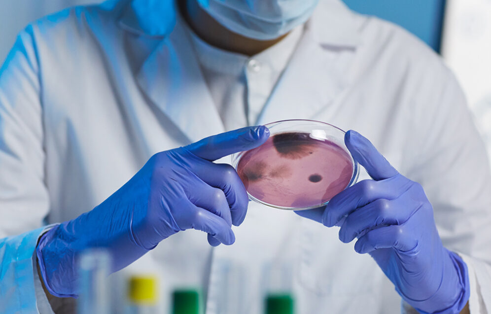 Komórki macierzyste w chirurgii plastycznej – przyszłość regeneracji skóry