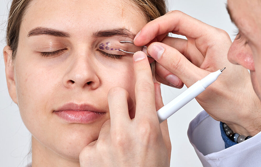 Chirurgia powiek (blefaroplastyka) – zabieg poprawiający wygląd i funkcję powiek.