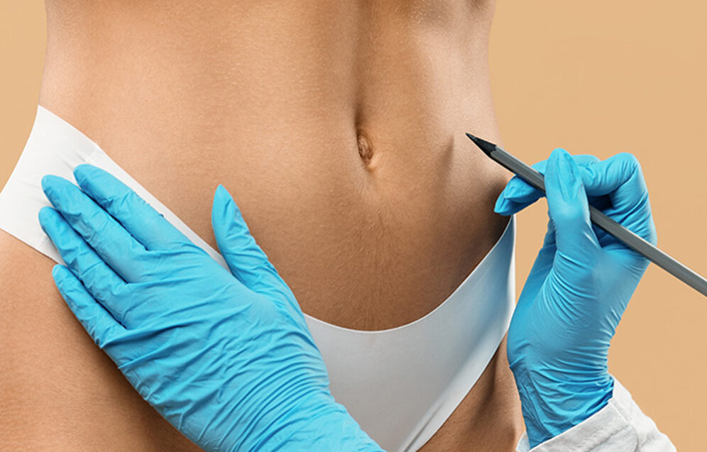 Zdrowotne aspekty operacji plastycznych – wpływ zabiegów na funkcjonowanie całego ciała. Chirurgia plastyczna Wrocław.