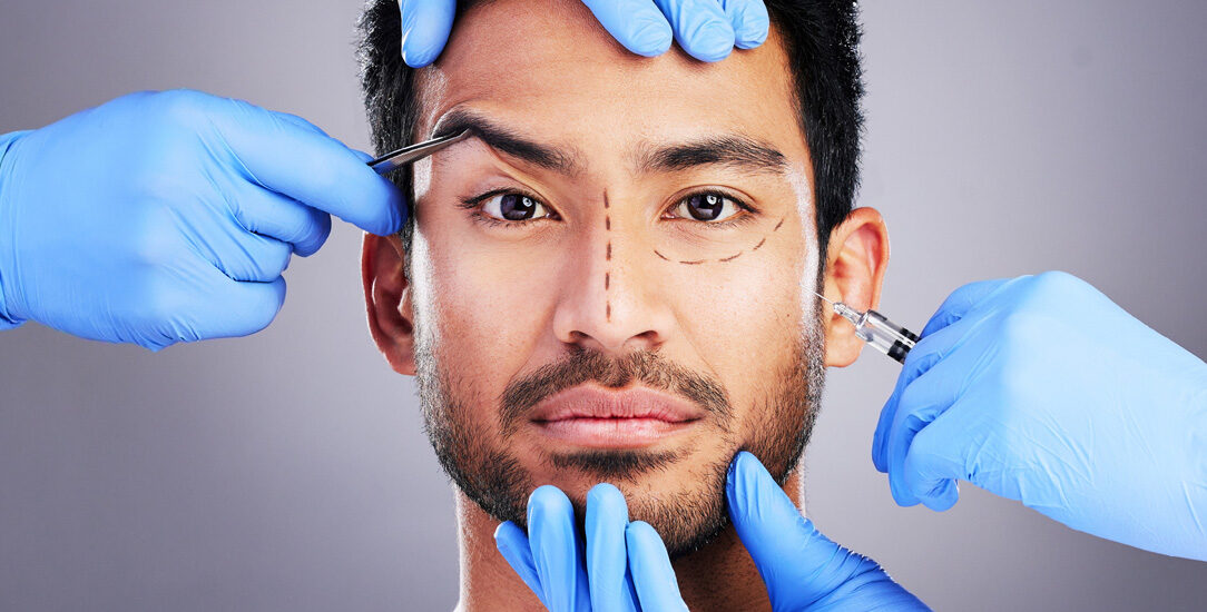 Zdjęcie przedstawia zabieg rekonstrukcji twarzy, który pomaga przywrócić estetykę i funkcjonalność twarzy po urazach lub deformacjach.