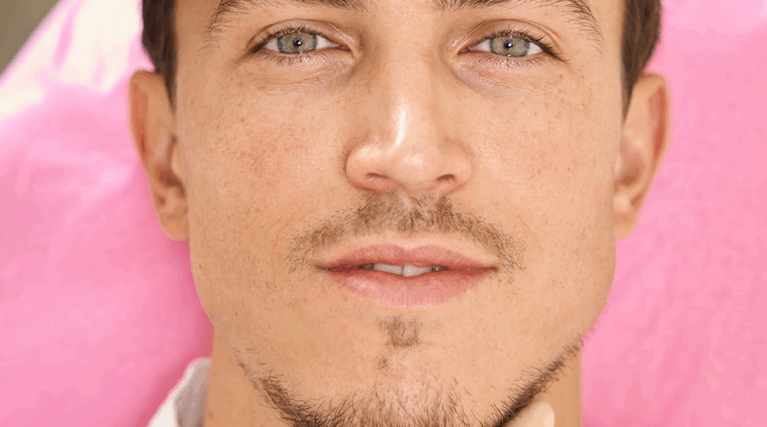 liplift meskie