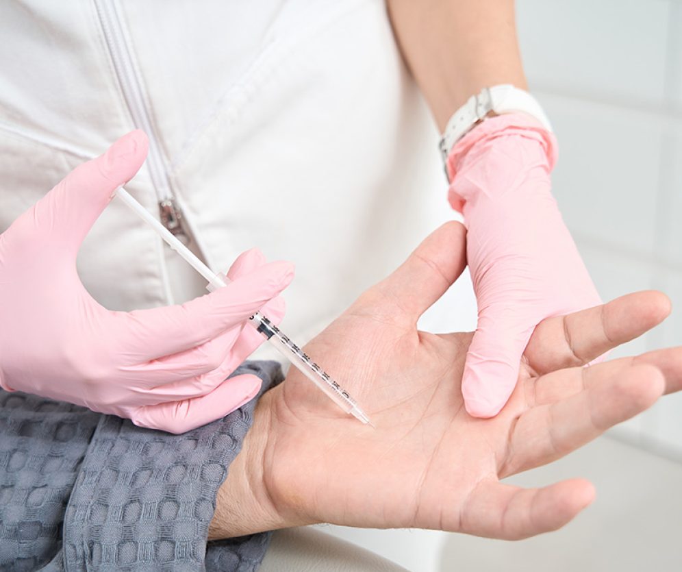 oropedia-wroclaw-operacja-przykurczu-dupuytrena-3