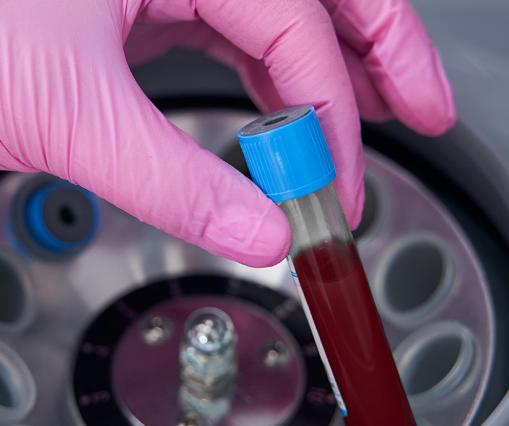 ortopedia-wroclaw-osocze-bogatoplytkowe-3